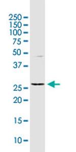 TNFAIP6 Antibody in Western Blot (WB)