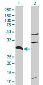 TNFAIP6 Antibody in Western Blot (WB)