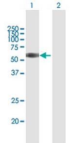 TNFRSF1B Antibody in Western Blot (WB)