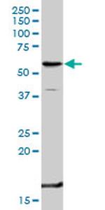 TNFRSF1B Antibody in Western Blot (WB)