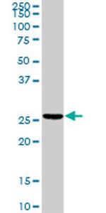 TNNI2 Antibody in Western Blot (WB)