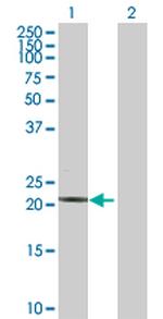 TNNI2 Antibody in Western Blot (WB)