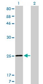 TNNI3 Antibody in Western Blot (WB)