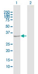 TNNT1 Antibody in Western Blot (WB)