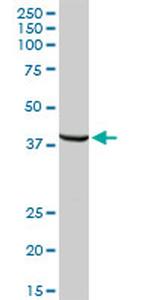 TPBG Antibody in Western Blot (WB)