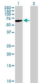 TPBG Antibody in Western Blot (WB)