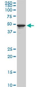 TPBG Antibody in Western Blot (WB)