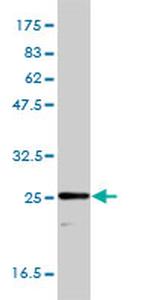 TPI1 Antibody in Western Blot (WB)