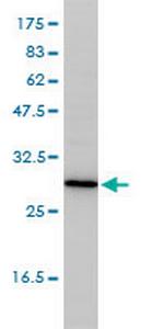 TPMT Antibody in Western Blot (WB)