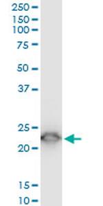 TPT1 Antibody in Western Blot (WB)