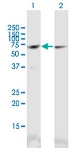 CCT3 Antibody in Western Blot (WB)