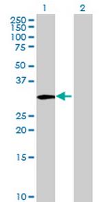 TST Antibody in Western Blot (WB)