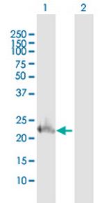 TWIST1 Antibody in Western Blot (WB)