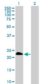 TWIST1 Antibody in Western Blot (WB)