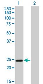 TWIST1 Antibody in Western Blot (WB)