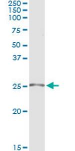 TWIST1 Antibody in Immunoprecipitation (IP)