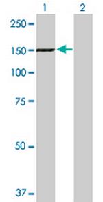 TYK2 Antibody in Western Blot (WB)