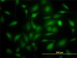 TYMS Antibody in Immunocytochemistry (ICC/IF)