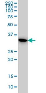 TYMS Antibody in Western Blot (WB)