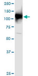 UBA1 Antibody in Western Blot (WB)