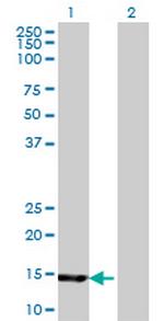 UBE2B Antibody in Western Blot (WB)