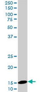 UBE2D2 Antibody in Western Blot (WB)