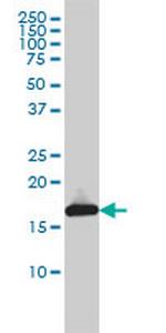 UBE2L3 Antibody in Western Blot (WB)