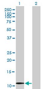 UBE2V1 Antibody in Western Blot (WB)