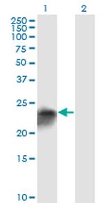 UCHL1 Antibody in Western Blot (WB)