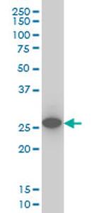 UCHL1 Antibody in Western Blot (WB)