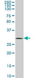 UCP1 Antibody in Western Blot (WB)