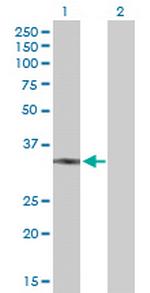 UCP2 Antibody in Western Blot (WB)