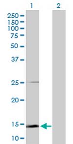 SCGB1A1 Antibody in Western Blot (WB)