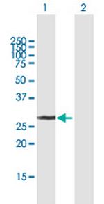 UCK2 Antibody in Western Blot (WB)