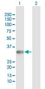 UCK2 Antibody in Western Blot (WB)