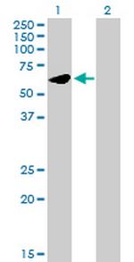 UMPS Antibody in Western Blot (WB)