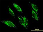 UQCRC1 Antibody in Immunocytochemistry (ICC/IF)