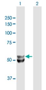 UQCRC1 Antibody in Western Blot (WB)