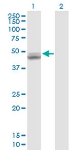 UQCRC1 Antibody in Western Blot (WB)