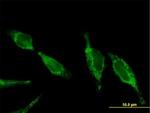 UQCRC2 Antibody in Immunocytochemistry (ICC/IF)