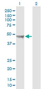 UQCRC2 Antibody in Western Blot (WB)