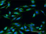 UQCRC2 Antibody in Immunocytochemistry (ICC/IF)