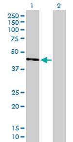 UQCRC2 Antibody in Western Blot (WB)