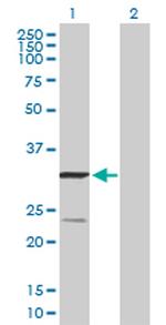 UQCRFS1 Antibody in Western Blot (WB)