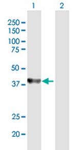 UROD Antibody in Western Blot (WB)