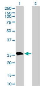 UROS Antibody in Western Blot (WB)