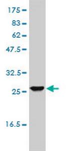 UROS Antibody in Western Blot (WB)