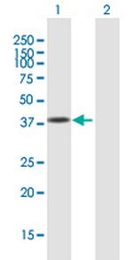 USF1 Antibody in Western Blot (WB)