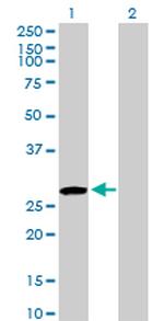 USF1 Antibody in Western Blot (WB)