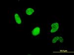 USF2 Antibody in Immunocytochemistry (ICC/IF)